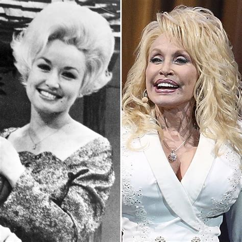 dolly parton natural breasts|Dolly Parton Plastic Surgery: 7 Times the Star Talked About Her。